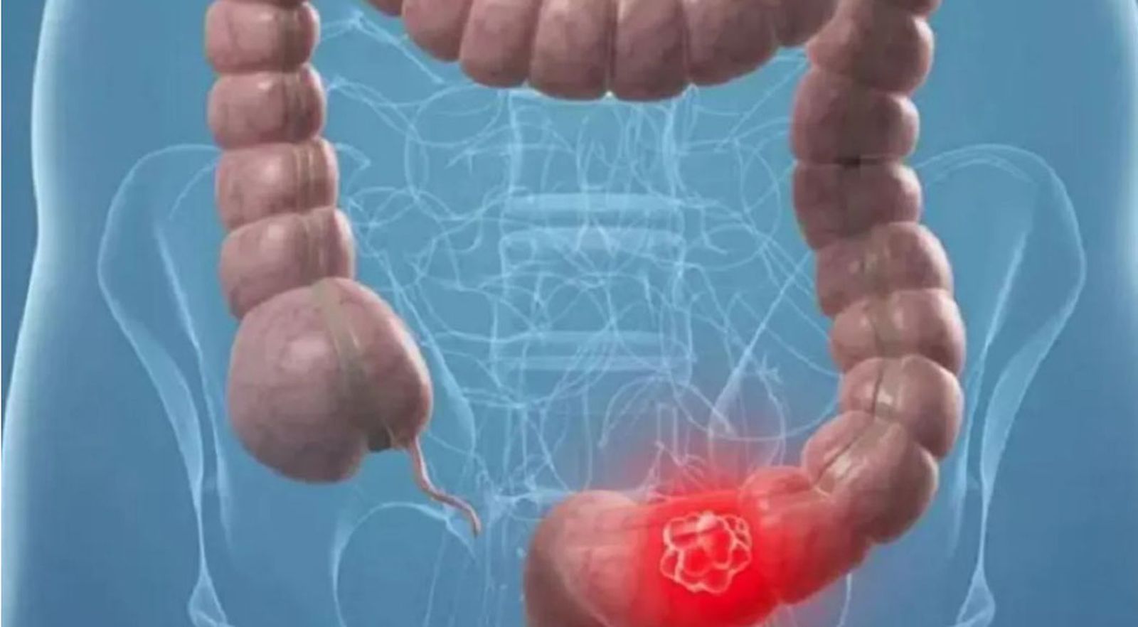 El contrato tendrá un año de duración