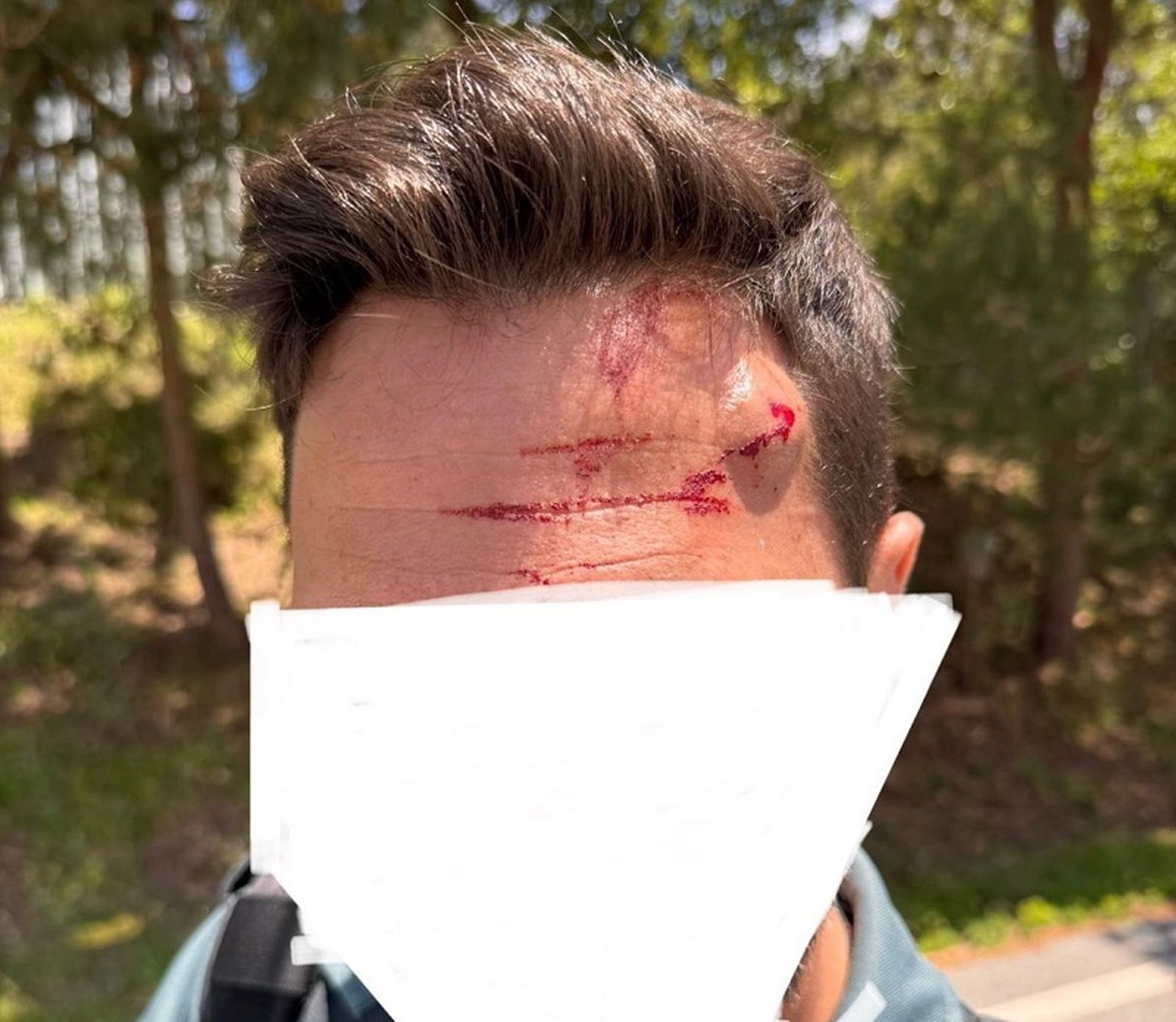 El agente de la Guardia Civil tras sufrir la agresión. / FOTO CEDIDA El agente de la Guardia Civil tras sufrir la agresión. / FOTO CEDIDA