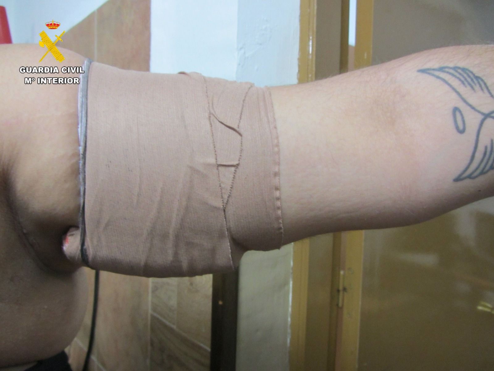 Imagen de uno de los brazos de la mujer detenida y donde ocultaba el hachís
