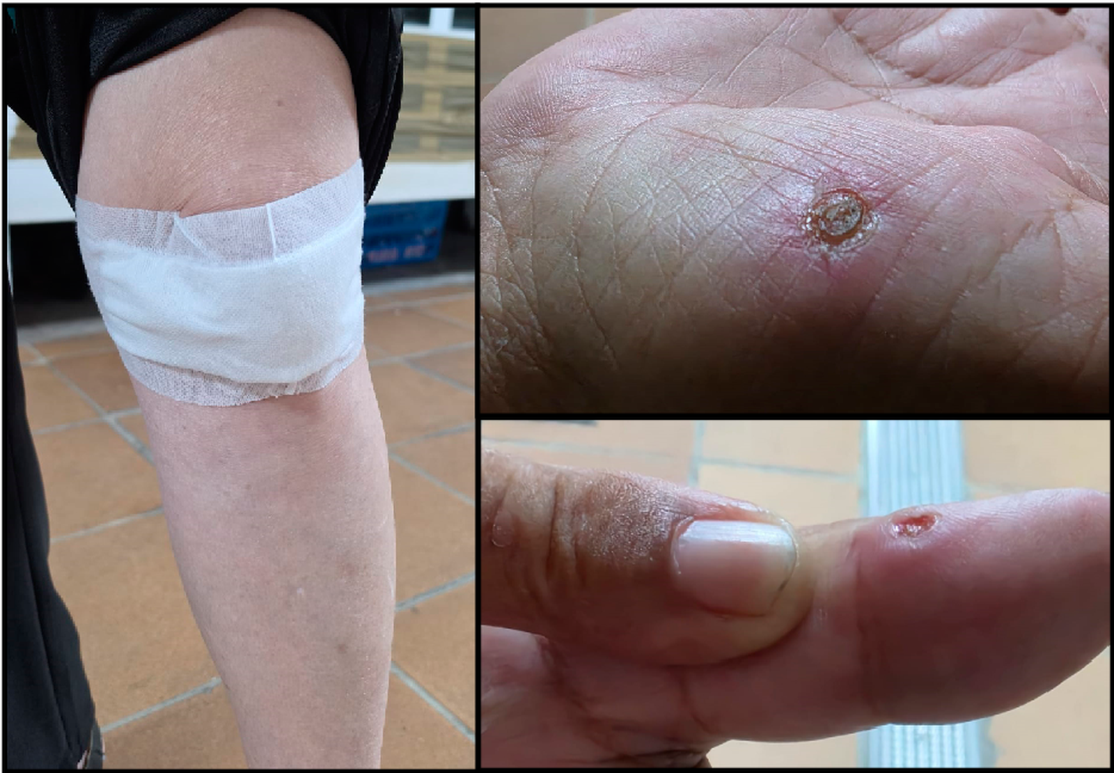Imágenes de las heridas sufridas por la víctima, que reconoce además tener "fuertes dolores en las costillas"