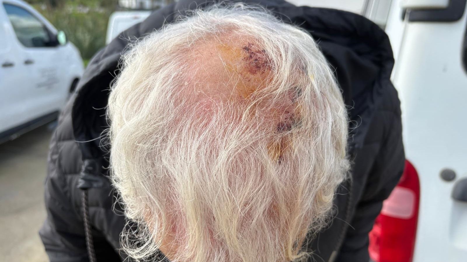 Vista cenital de la cabeza de Saddam.