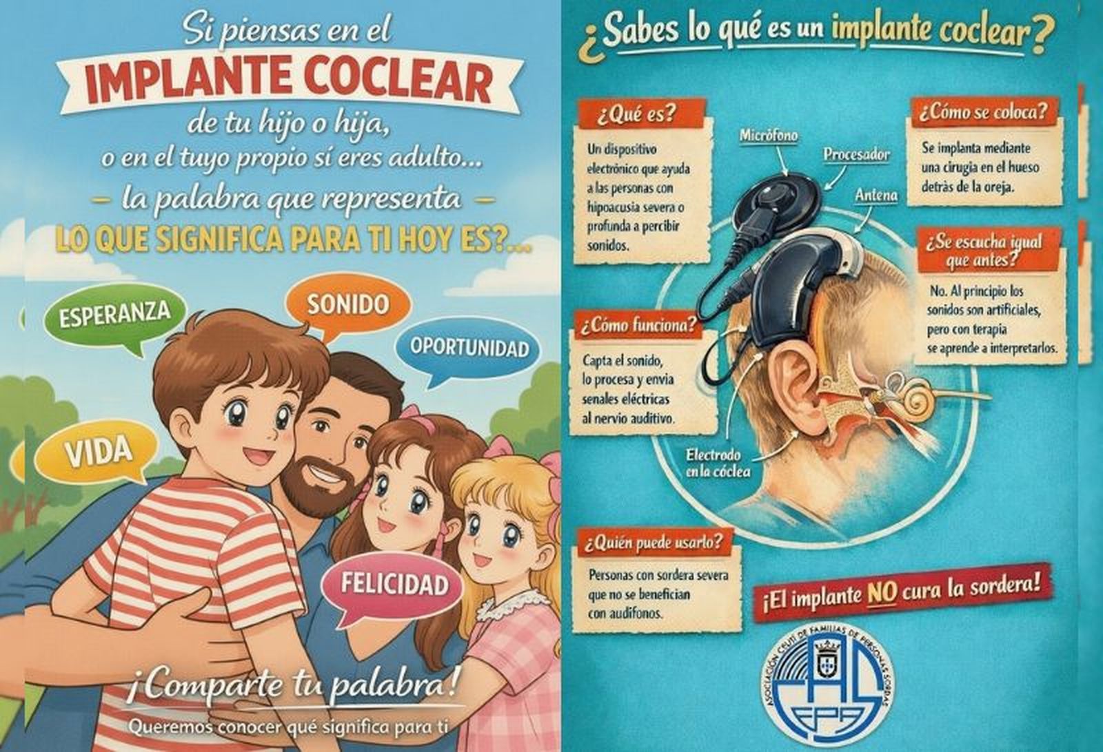 Infografía y cartel facilitado por ACEPAS por el Día del Implante Coclear.