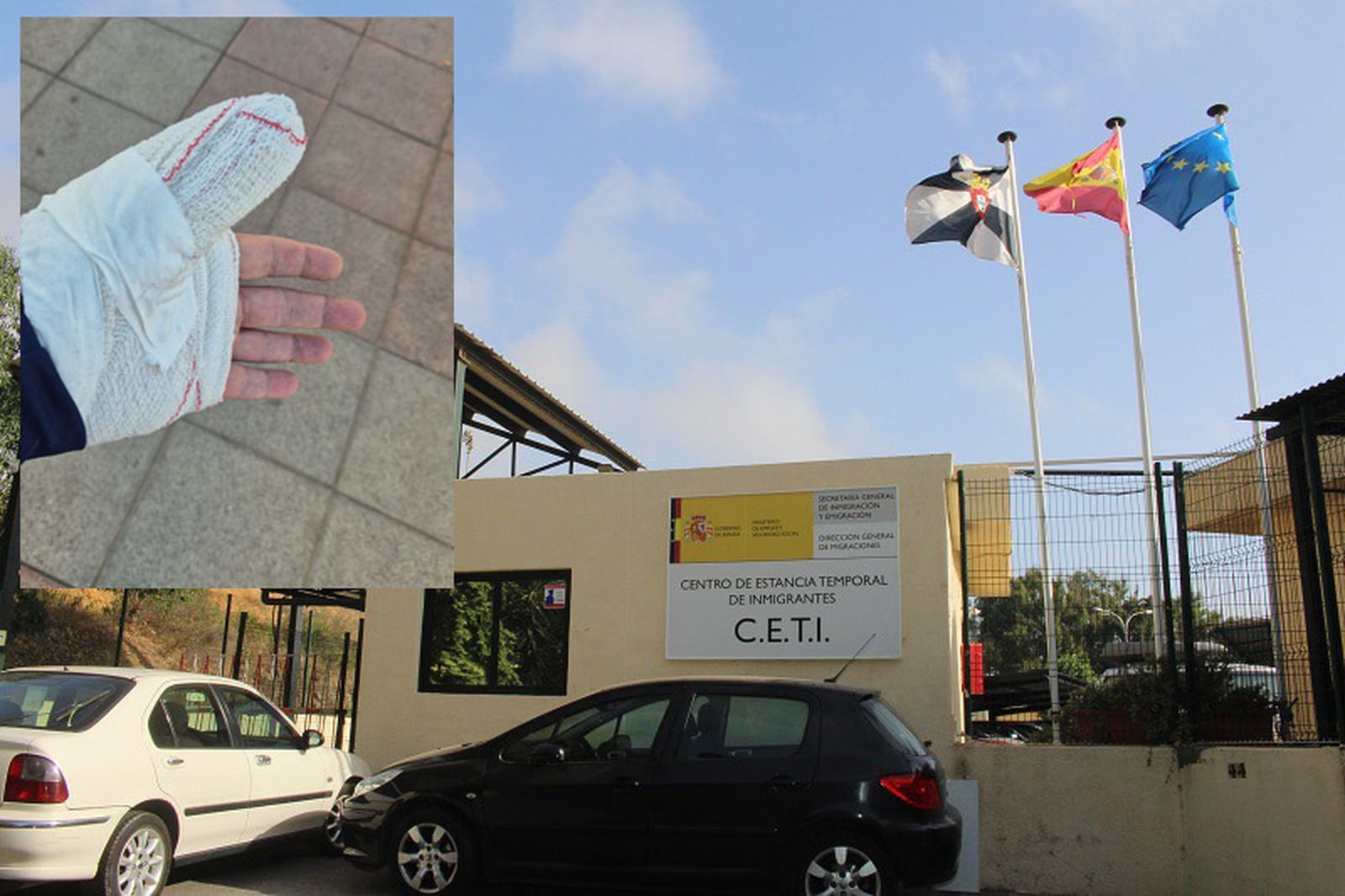 Dependencias del CETI. Arriba, esta de la mano de uno de los vigilantes tras la agresión/FOTO EL PUEBLO