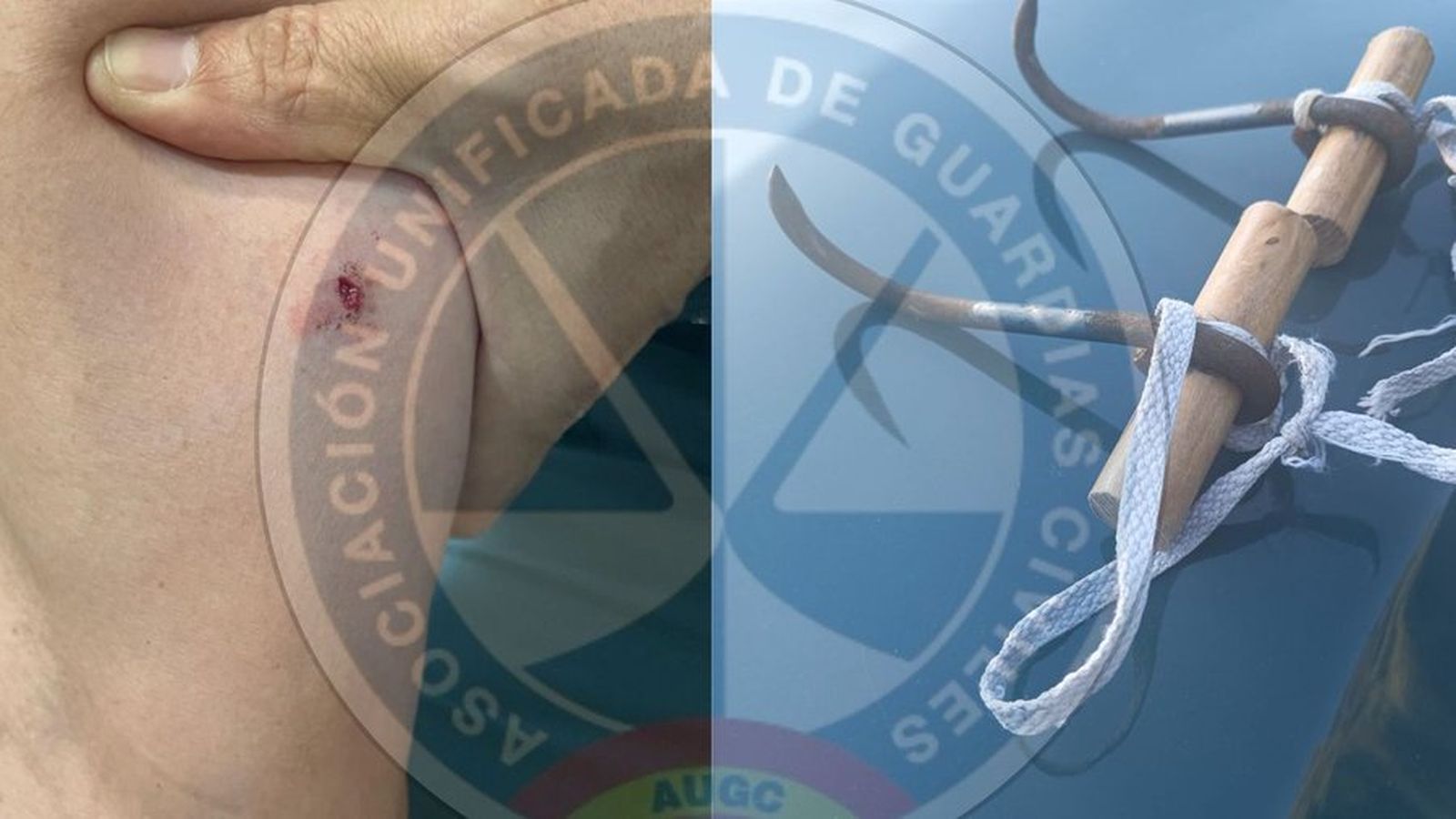 Imagen del garfio utilizado para atacar al agente de la Guardia Civil en la frontera de Ceuta y la herida producida