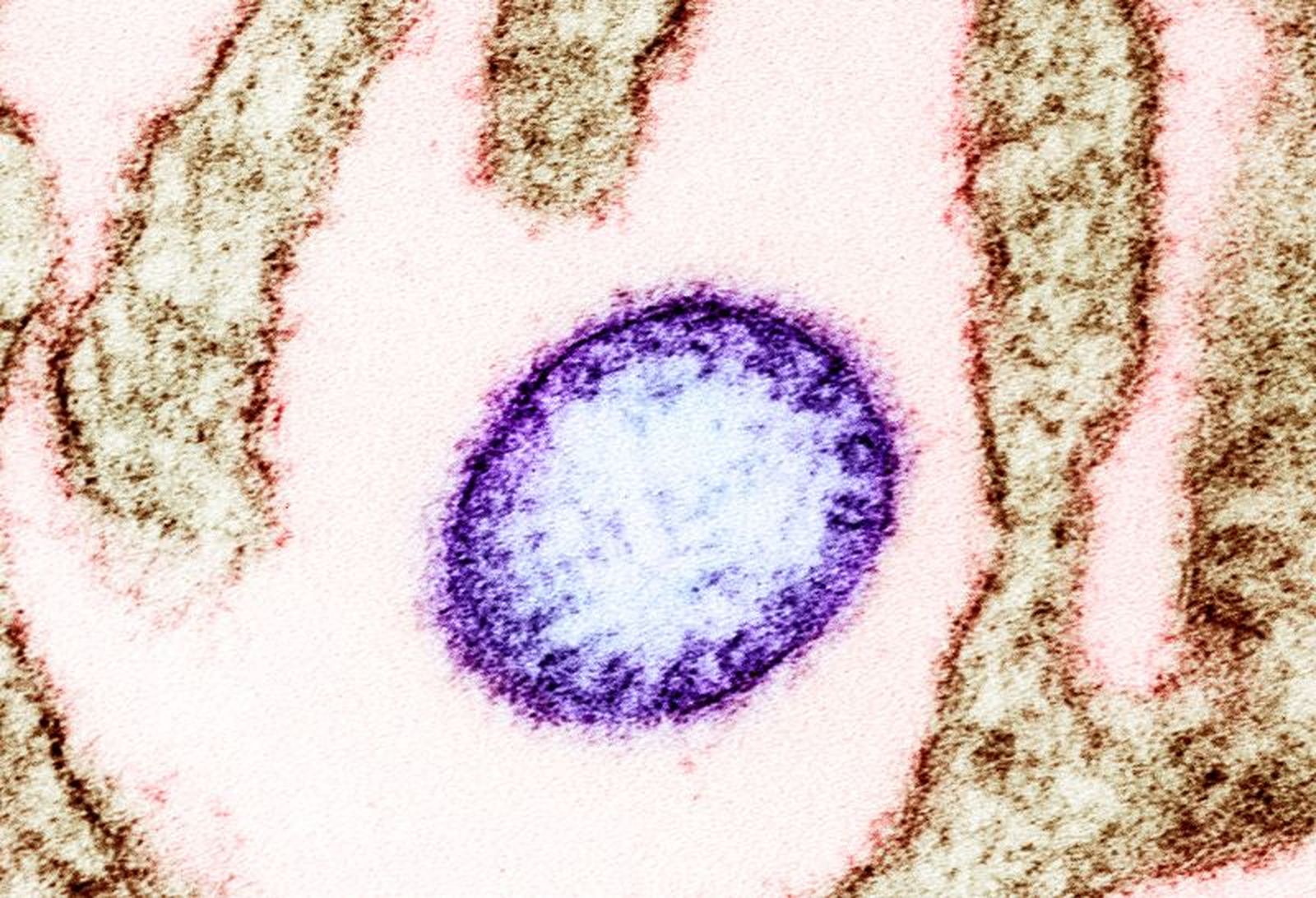 Micrografía electrónica de una partícula del virus Nipah.