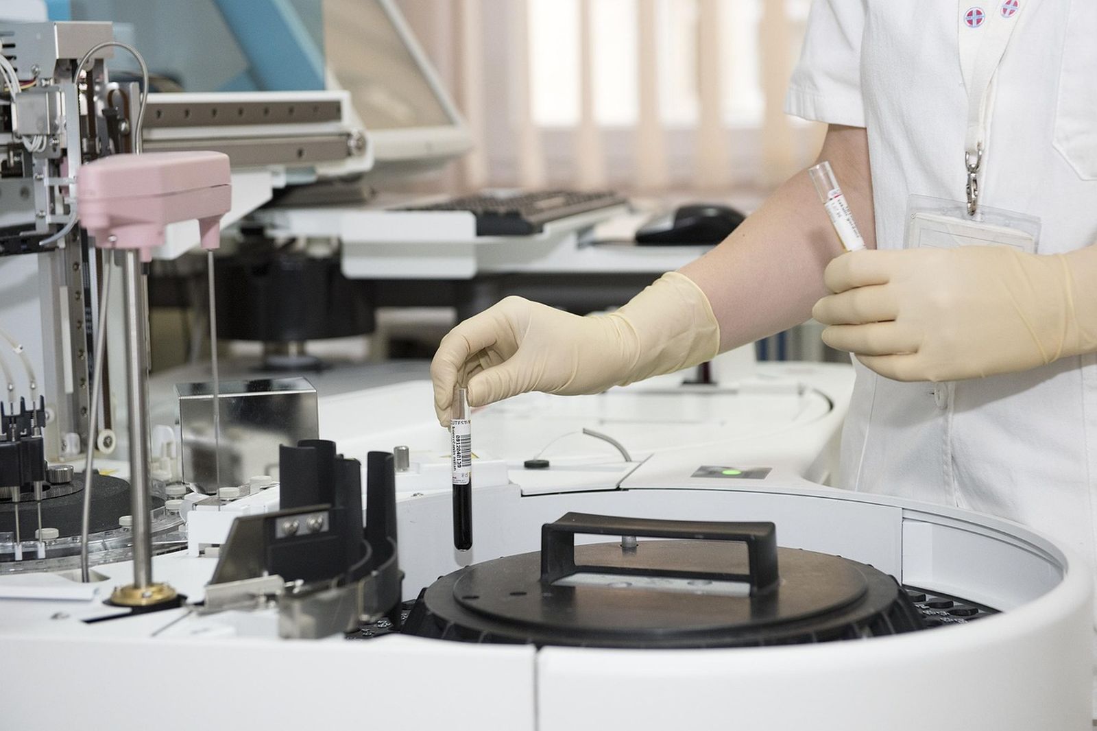 En el mundo existen más de 40 millones de donantes de médula ósea registrados en los 88 registros que forman parte de la World Marrow Donor Association (WMDA