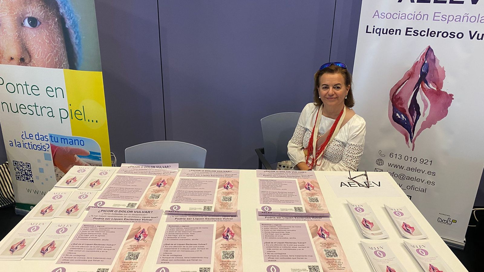Una usuaria de la Asociación Española de Liquen Escleroso Vulvar