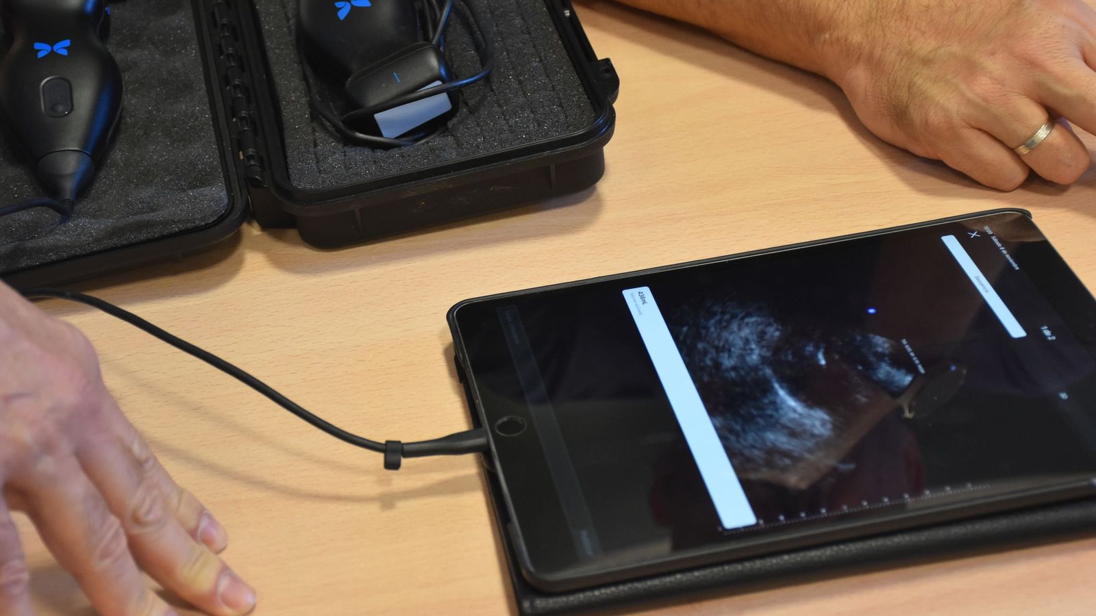 Ecógrafo con el que pueden visualizar la vena en tiempo real y facilitar la introducción del catéter