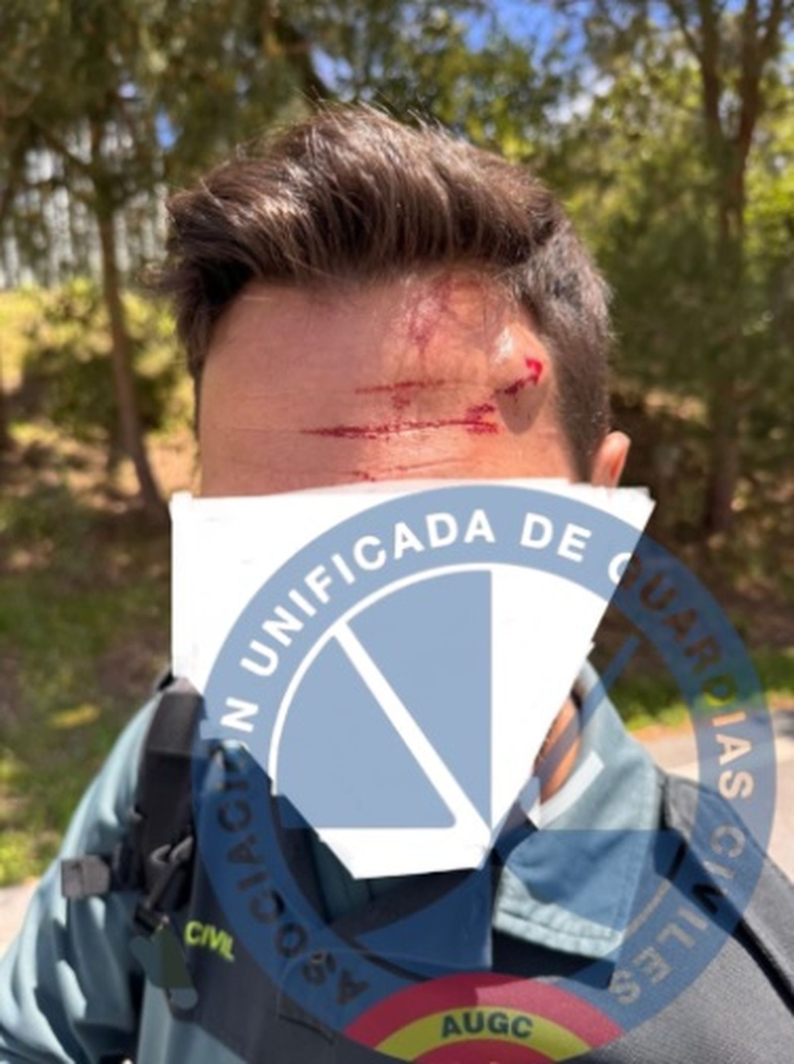 Un guardia civil agredido por un migrante en la frontera de Ceuta. / FOTO CEDIDA