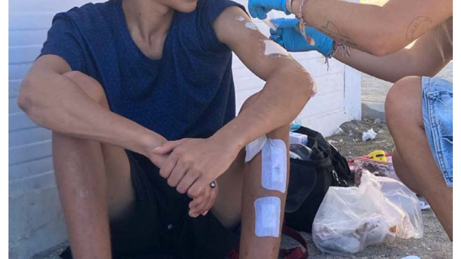 Un menor joven migrante con lesiones mientras es atendido.