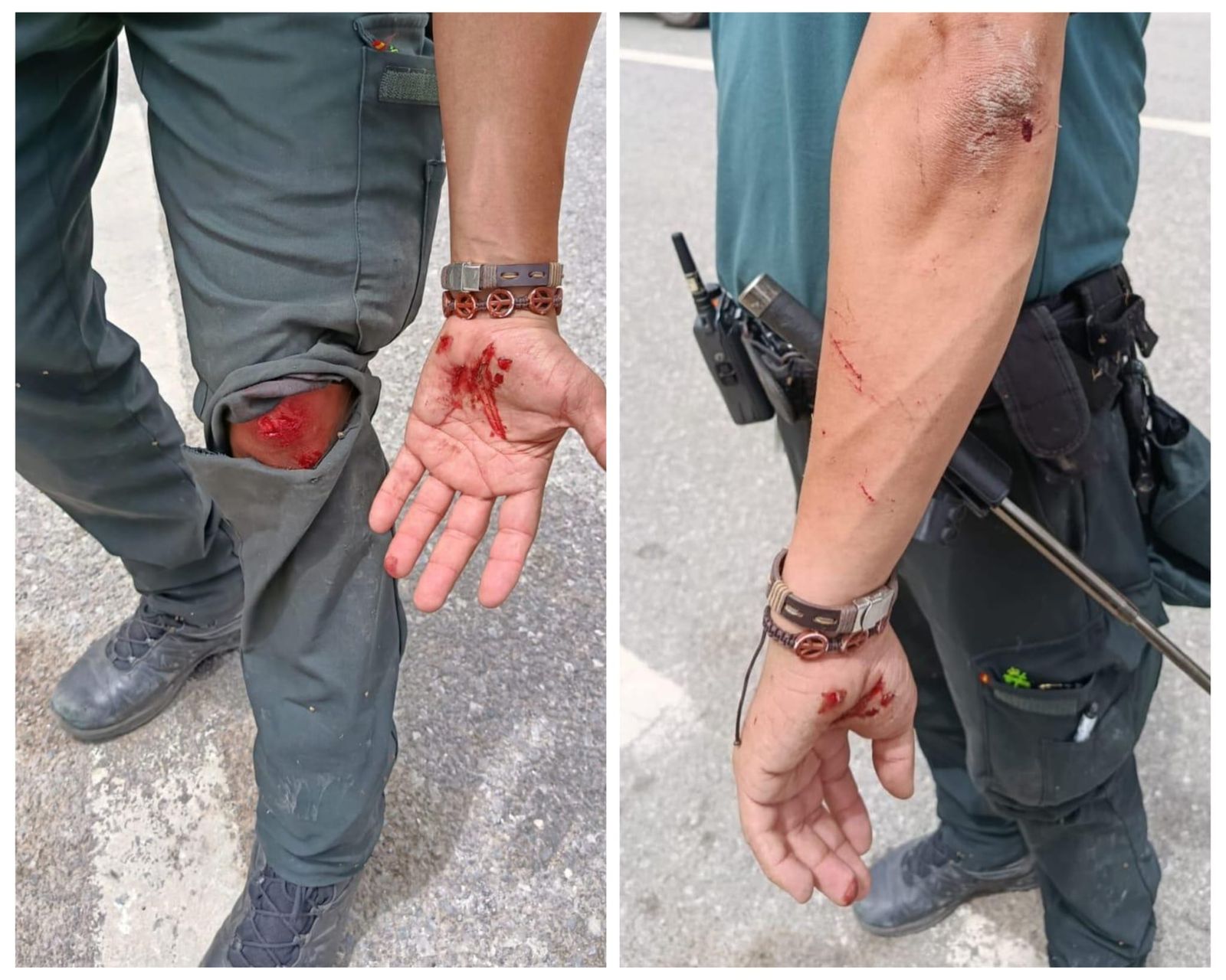Así quedó el guardia civil herido en la frontera