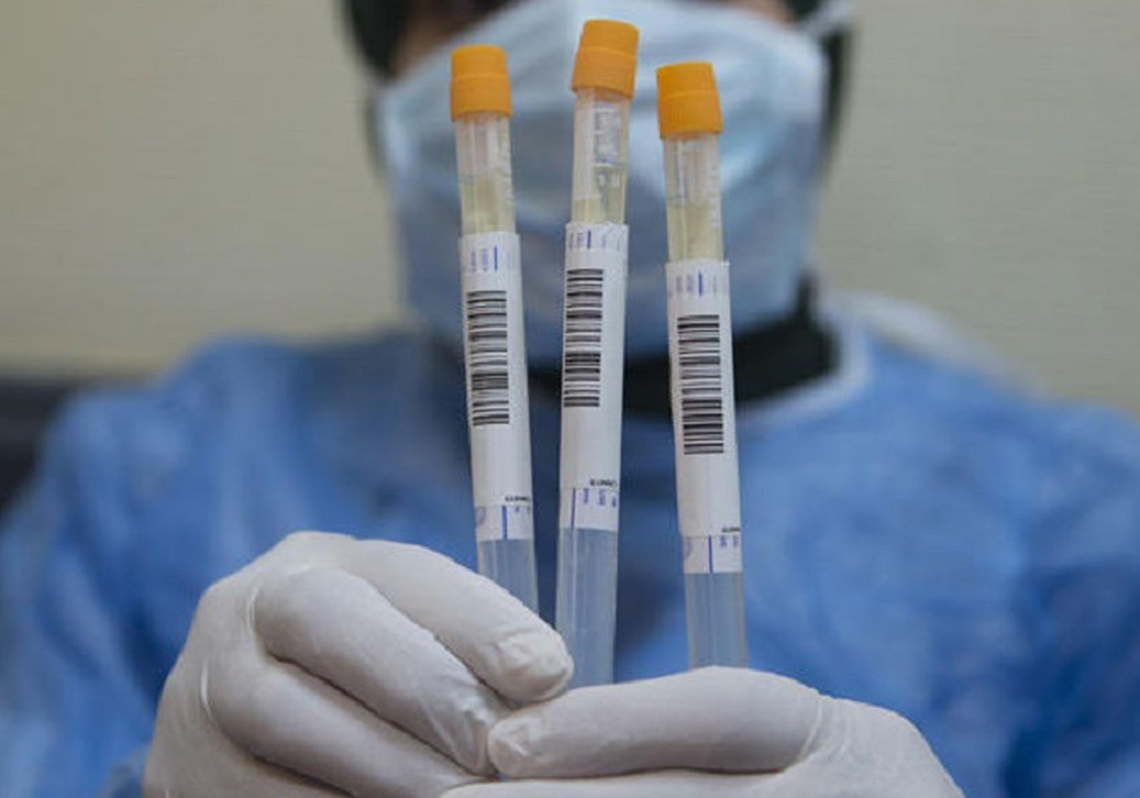 9499_test-rapidos-coronavirus 9499_test-rapidos-coronavirus