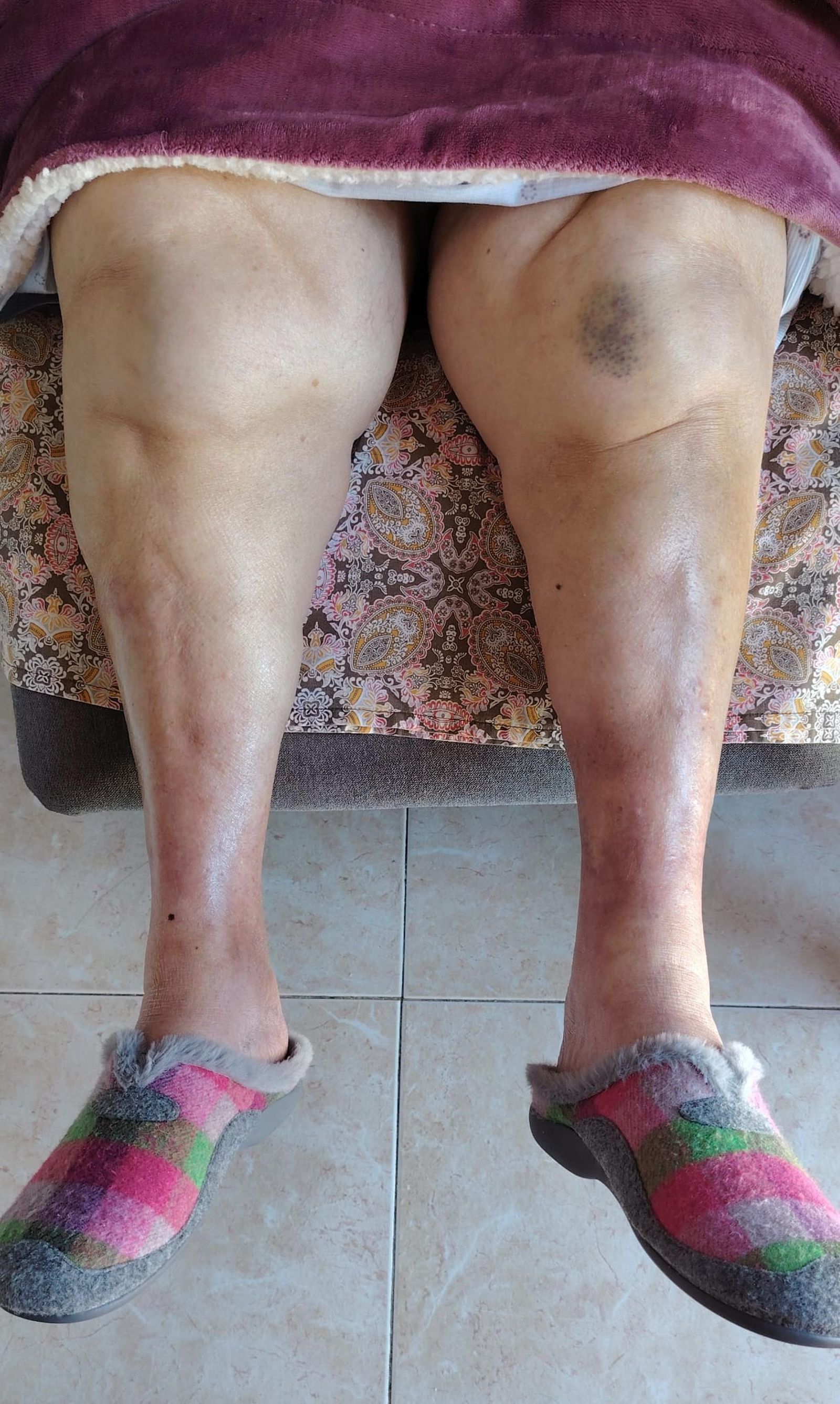 Piernas de la abuela de 81 años.