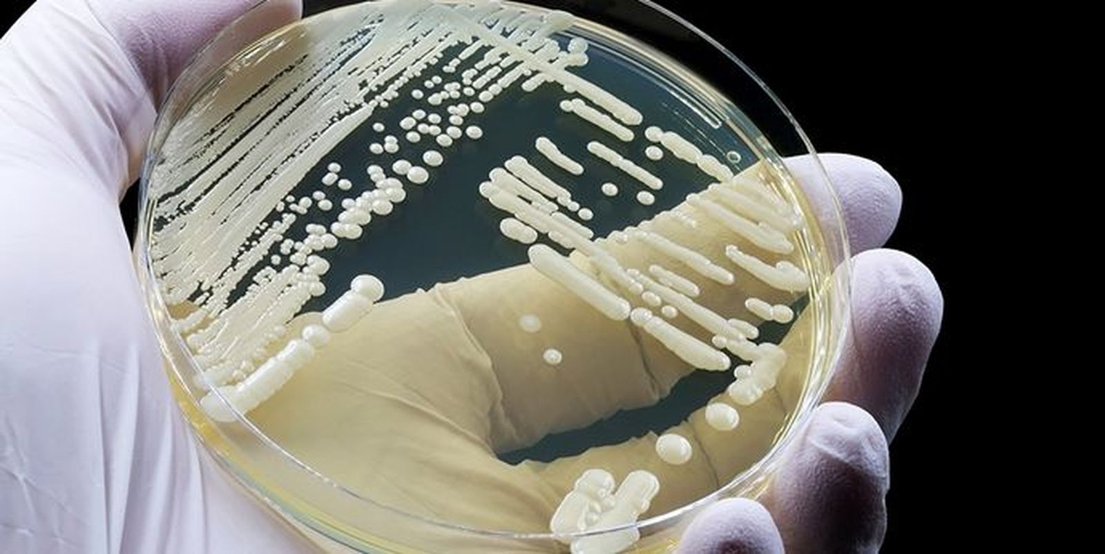 9733_candida-auris