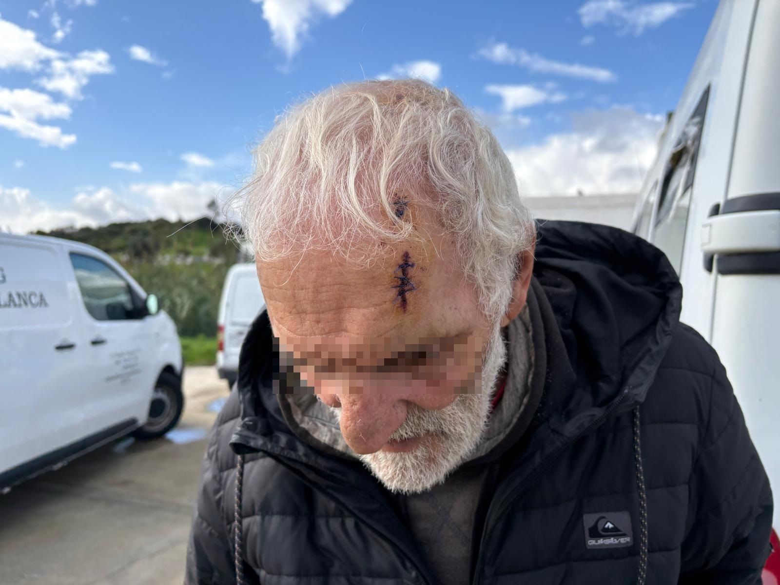 Saddam muestra sus heridas en la cabeza.