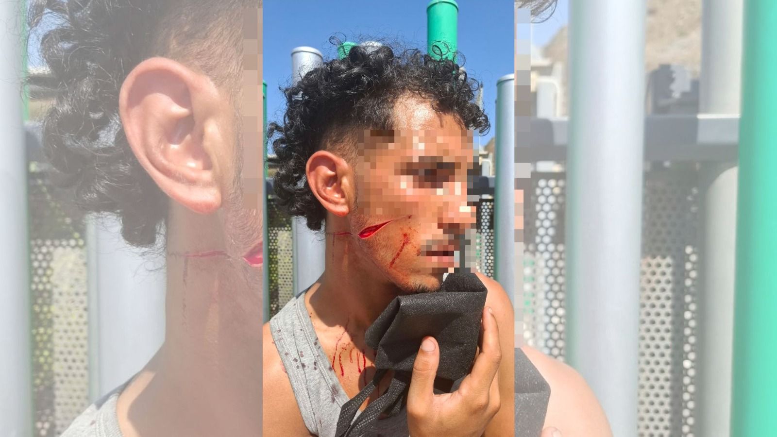 Un migrante ha sido detenido y otro ha tenido que ser trasladado al Hospital Universitario de Ceuta con un profundo corte en la cara después de una pelea registrada este martes a las puertas de un supermercado de la ciudad