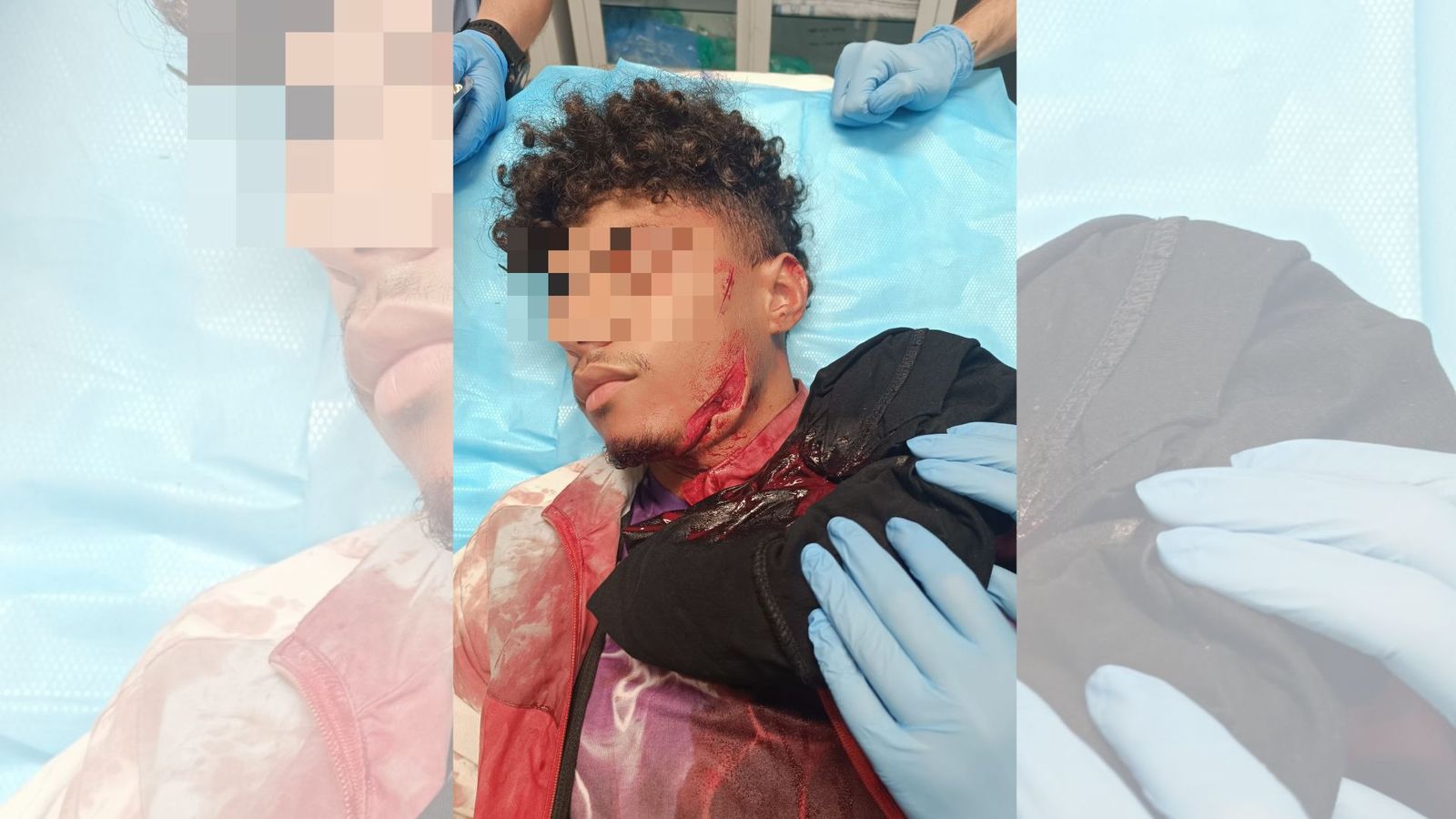 El joven migrante agredido con arma blanca en la cara durante una reyerta en el Trampolín
