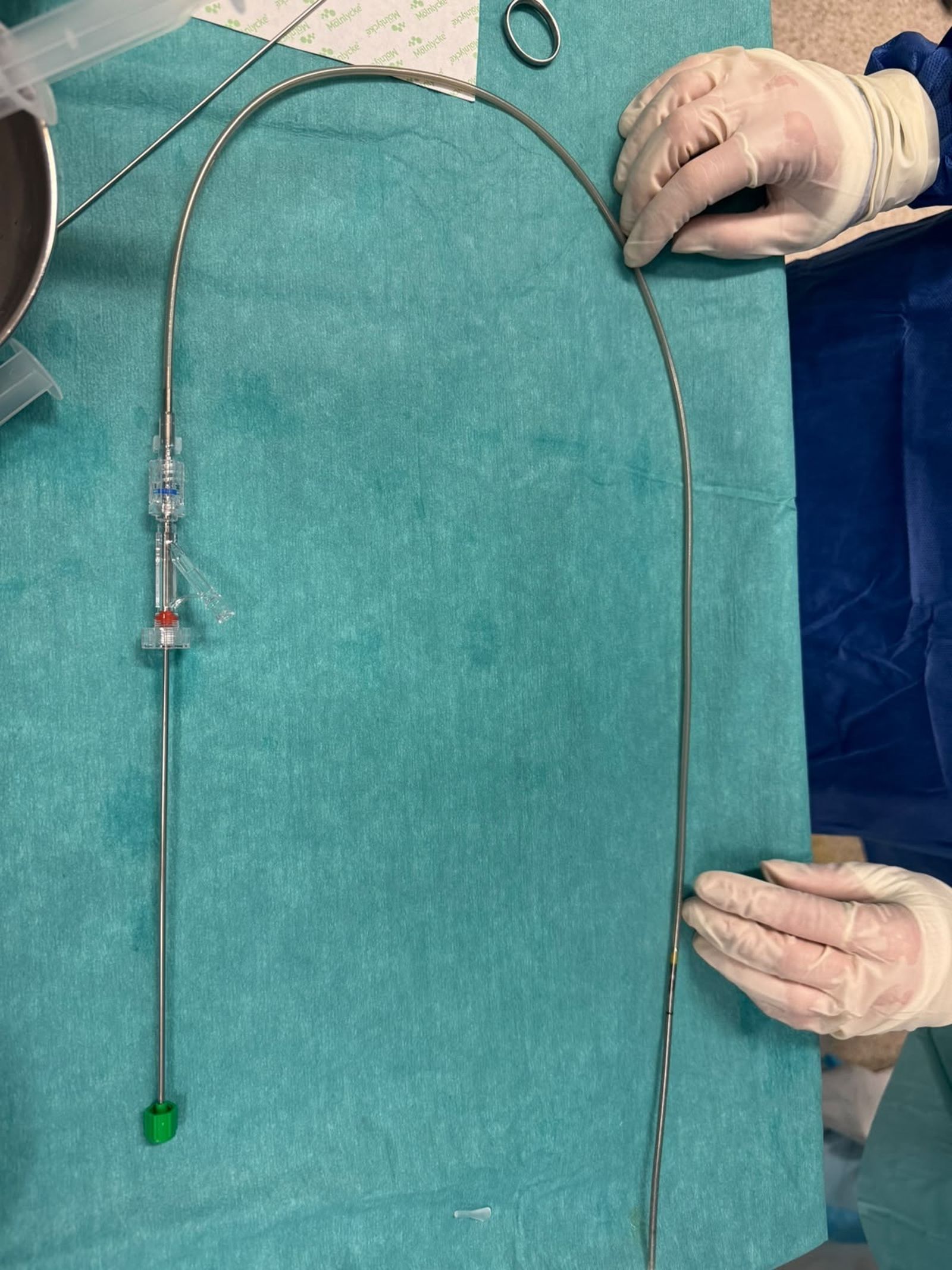 El HUCE implanta con éxito el primer stent de tecnología avanzada Allium en Ceuta