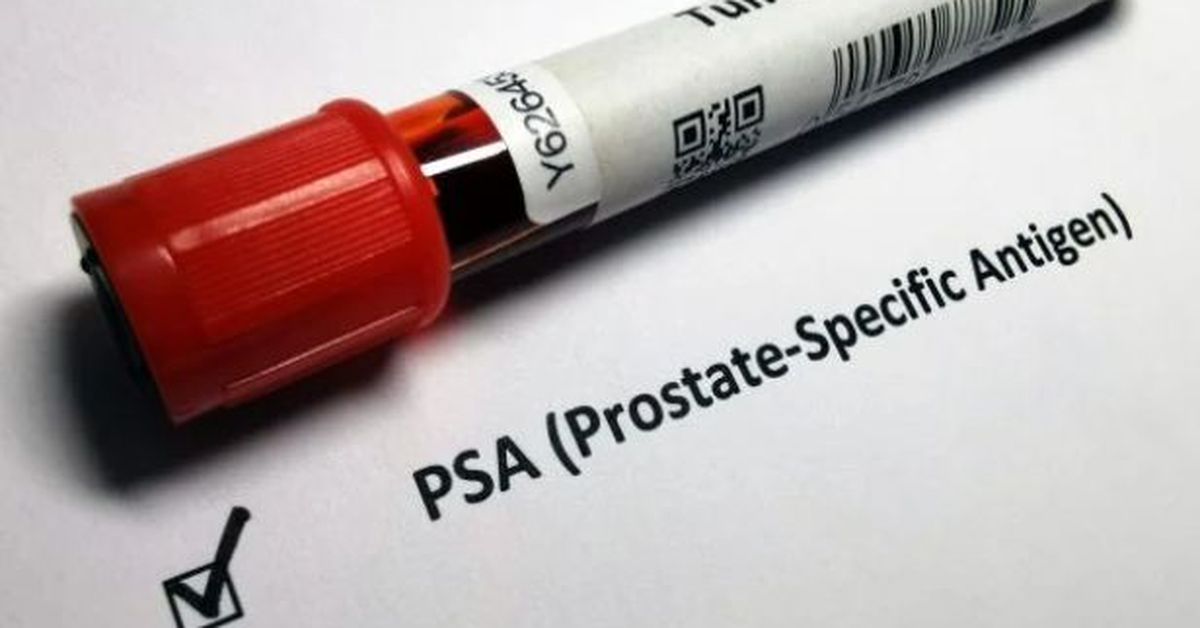 El test de PSA impulsa el diagnóstico precoz del cáncer de próstata en ...